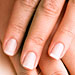 Anemia Fingernails