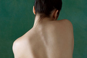 osteoporosis-condition