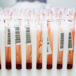 cholesterol-blood-tests