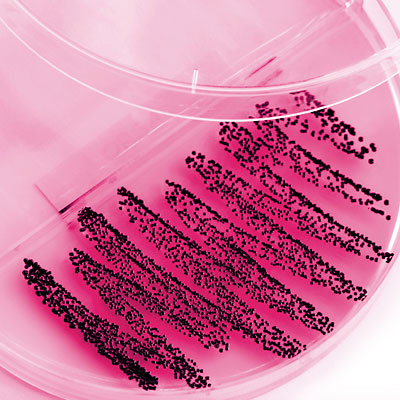 pap-smear