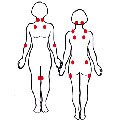 fibro-diagram