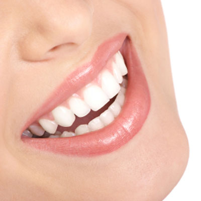 teeth-stain-remover