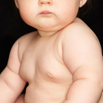 overweight-baby-insurance