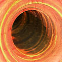 endoscope-intestine