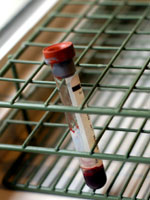 menopause-blood-test