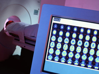 positron-emission-tomography