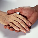 brown-spots-hands