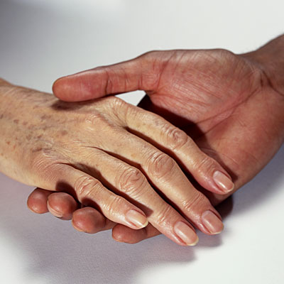 brown-spots-hands