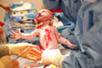baby-delivery-surgery