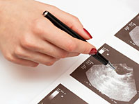 ovarian-cancer