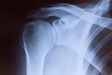 hot-flashes-bone-check