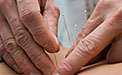 acupuncture-back-pain