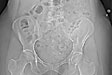 pelvic-alt-med-fix