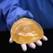breastimplants-health