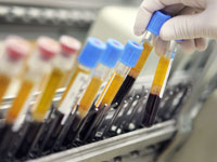 diabetes-type-2-blood-test