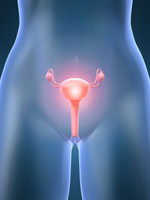 polycystic-ovaries-uteris