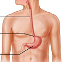 have-gerd