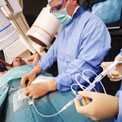angiogram-catheter