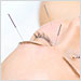 acupuncture-closeup