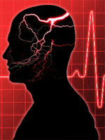 emergency-headache