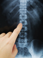 finger-pointing-spine