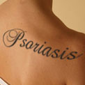 psoriasis-tattoo