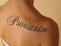 Tattoo Psoriasis