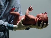 circumcision