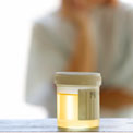 woman-urine-test-chlamydia