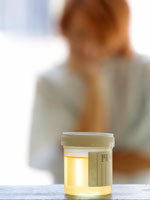 woman-urine-test-chlamydia