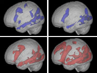 aging brain