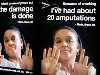 smoking-ad-missing-fingers