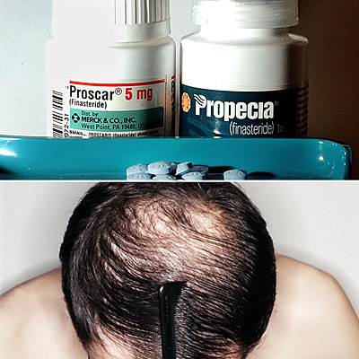 Finasteride orden