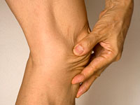 ra-joint-pain