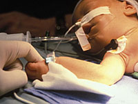 anesthesia-infant-adhd