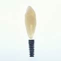 tooth-impant