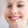 tooth-veneers