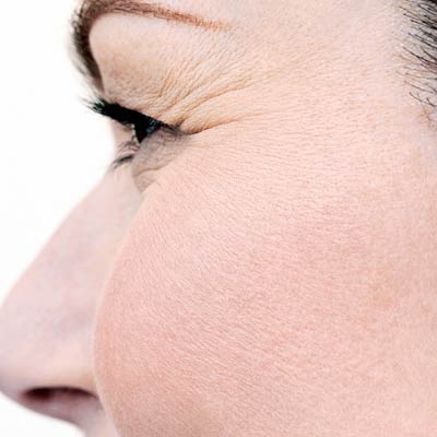 eye-crows-feet