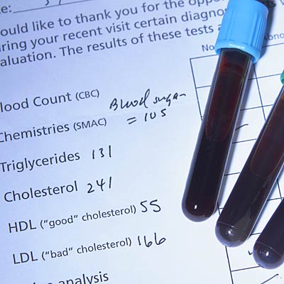 cholesterol test medical health tests getty credit