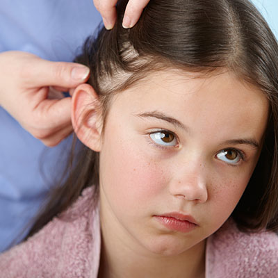 20 Ways to Kill Head Lice