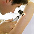 skin-test