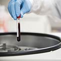 women-blood-test
