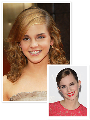 Emma Watson