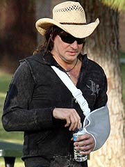 Bon Jovi's Richie Sambora Breaks His Arm | Richie Sambora