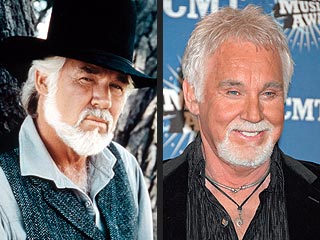 kenny rogers  plastic surgery