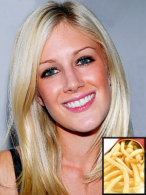 heidi montag surgery disaster. Heidi+montag+after+surgery