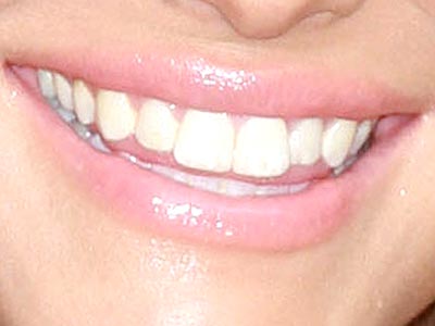 Pop Quiz: Guess That Smile! - P...