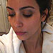 Check Out Kim Kardashian's Black Eye | Kim Kardashian