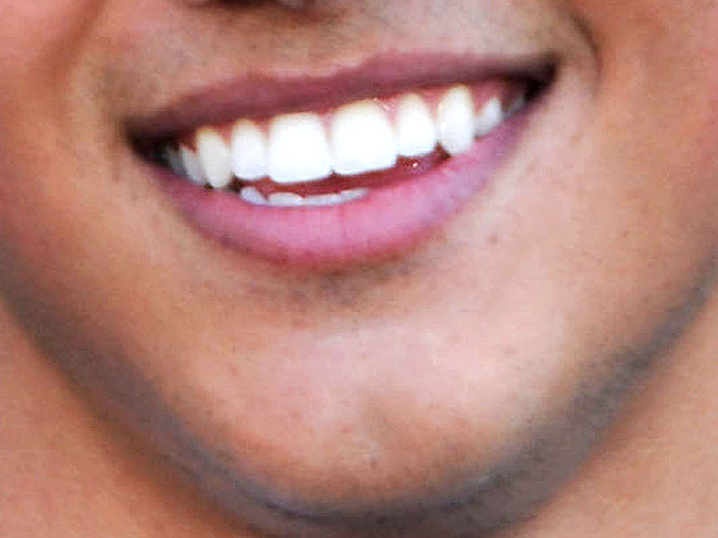 Sure, he's known more for his abs than his smile, but do you know who can grin and bare it?