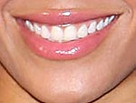 Pop Quiz: Guess That Smile!